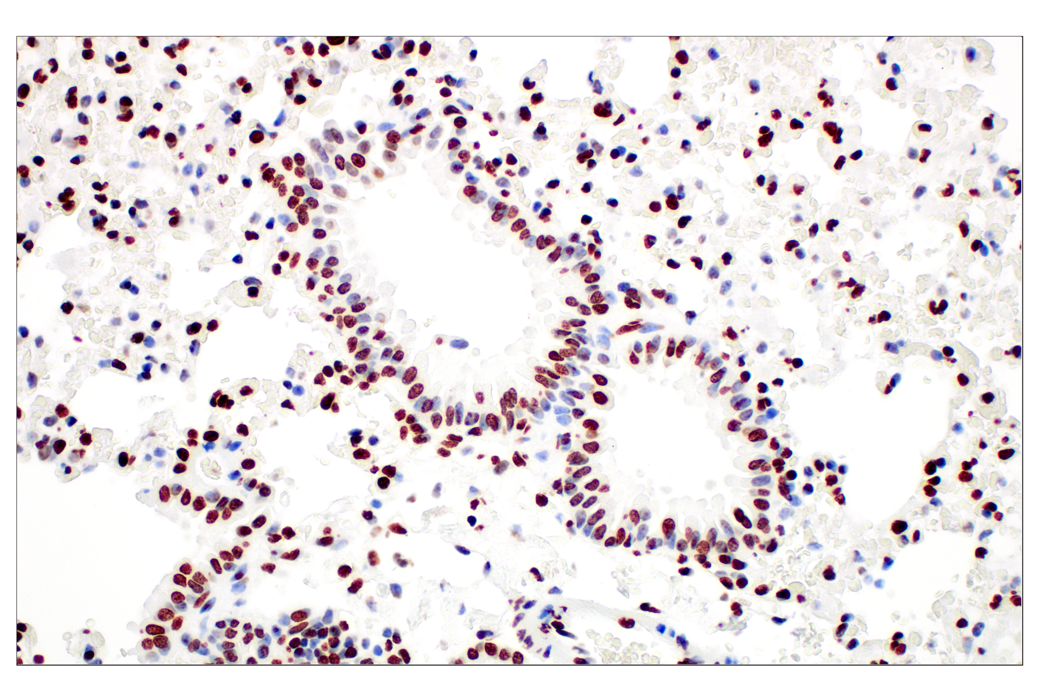Immunohistochemistry Image 3: Tri-Methyl-Histone H3 (Lys27) (C36B11) Rabbit mAb (BSA and Azide Free)