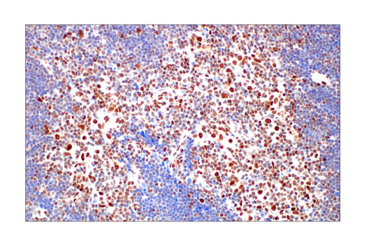 Immunohistochemistry Image 3: Tri-Methyl-Histone H3 (Lys27) (C36B11) Rabbit mAb (BSA and Azide Free)