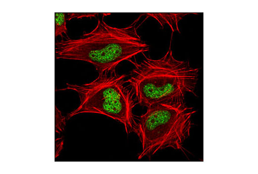 Immunofluorescence Image 1: Tri-Methyl-Histone H3 (Lys27) (C36B11) Rabbit mAb (BSA and Azide Free)