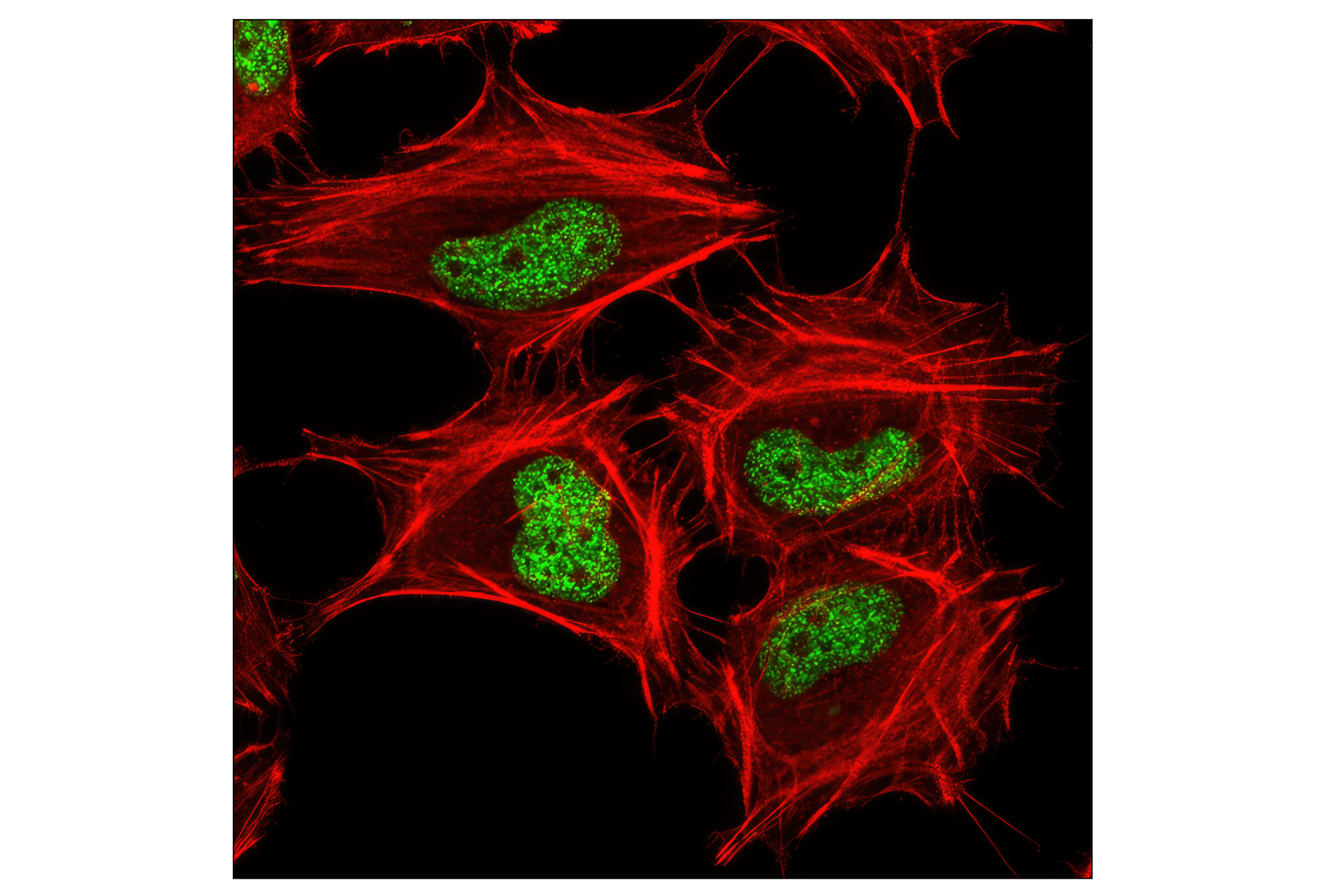 Immunofluorescence Image 1: Tri-Methyl-Histone H3 (Lys27) (C36B11) Rabbit mAb (BSA and Azide Free)