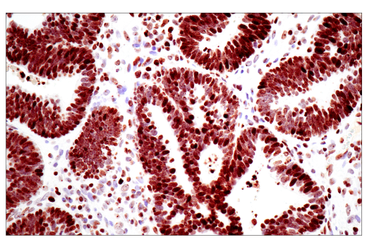 Immunohistochemistry Image 1: Tri-Methyl-Histone H3 (Lys27) (C36B11) Rabbit mAb (BSA and Azide Free)