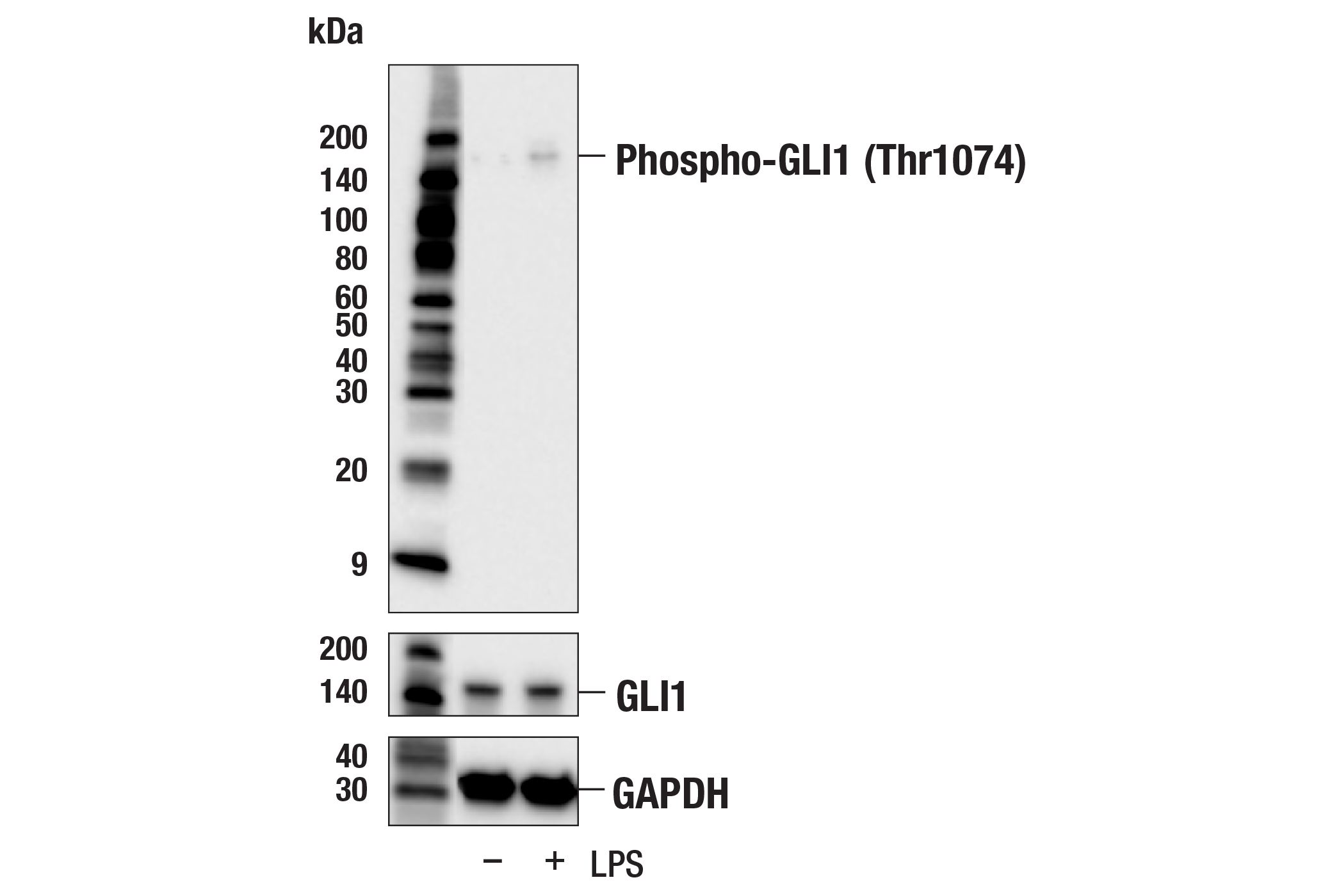 Western Blotting Image 1: Phospho-GLI1 (Thr1074) Antibody