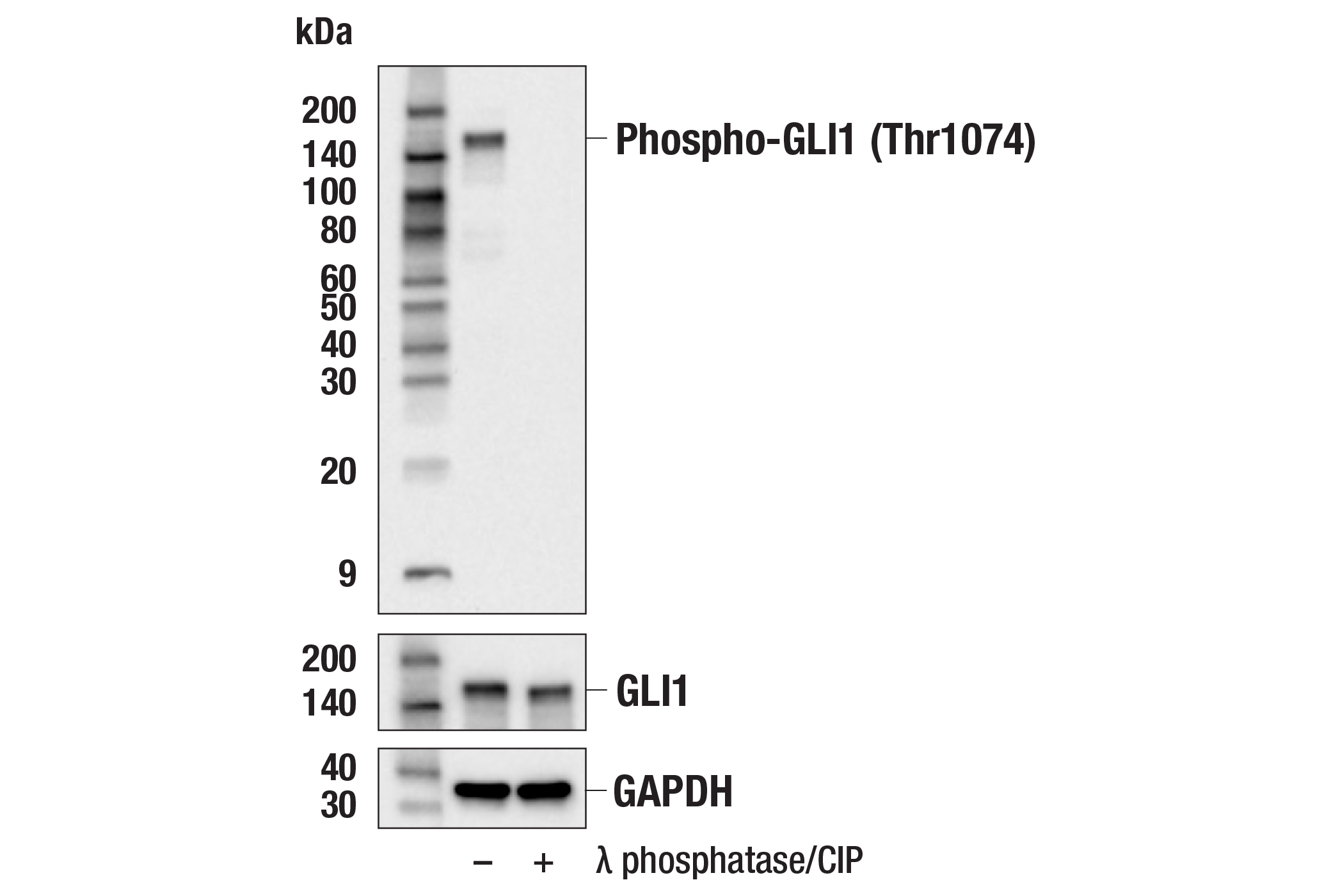Western Blotting Image 2: Phospho-GLI1 (Thr1074) Antibody