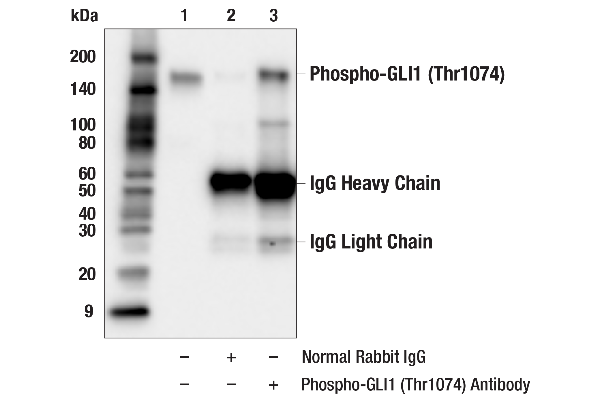 Immunoprecipitation Image 1: Phospho-GLI1 (Thr1074) Antibody