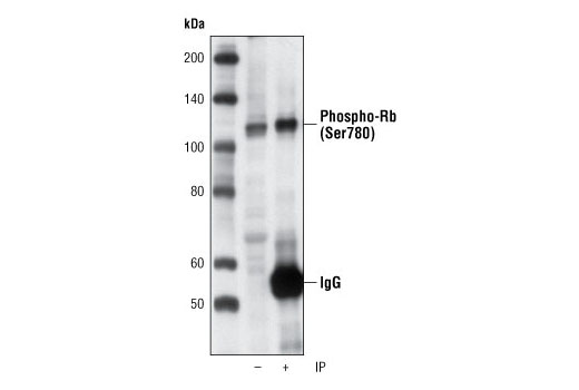 Immunoprecipitation Image 1: Phospho-Rb (Ser780) (C84F6) Rabbit mAb