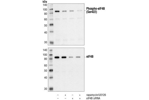 Western Blotting Image 1: Phospho-eIF4B (Ser422) Antibody
