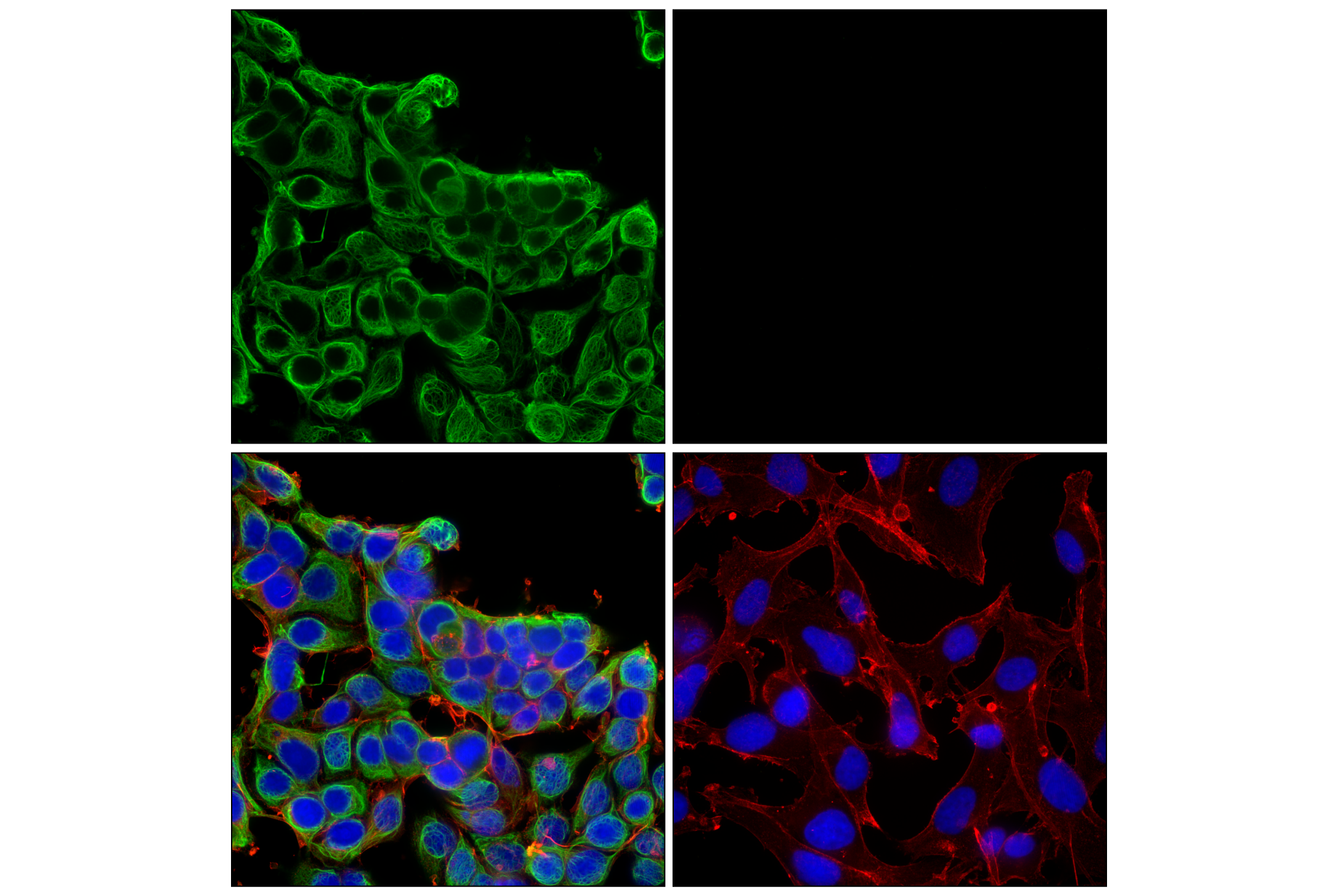Immunofluorescence Image 1: Keratin 8/18 (C51) Mouse mAb (Alexa Fluor® 488 Conjugate)