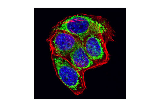 Immunofluorescence Image 1: Grp75 (D13H4) XP® Rabbit mAb