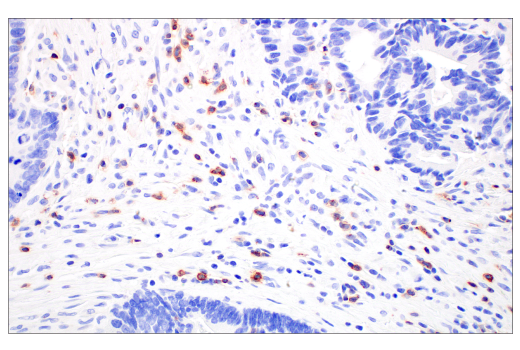 Immunohistochemistry Image 3: CD70 (E3Q1A) Rabbit mAb (BSA and Azide Free)