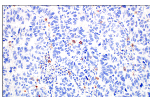 Immunohistochemistry Image 1: CD70 (E3Q1A) Rabbit mAb (BSA and Azide Free)