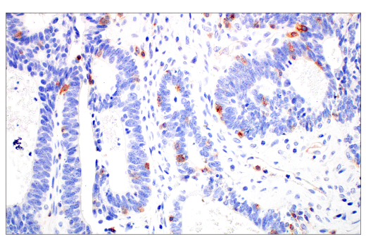 Immunohistochemistry Image 9: CD70 (E3Q1A) Rabbit mAb (BSA and Azide Free)