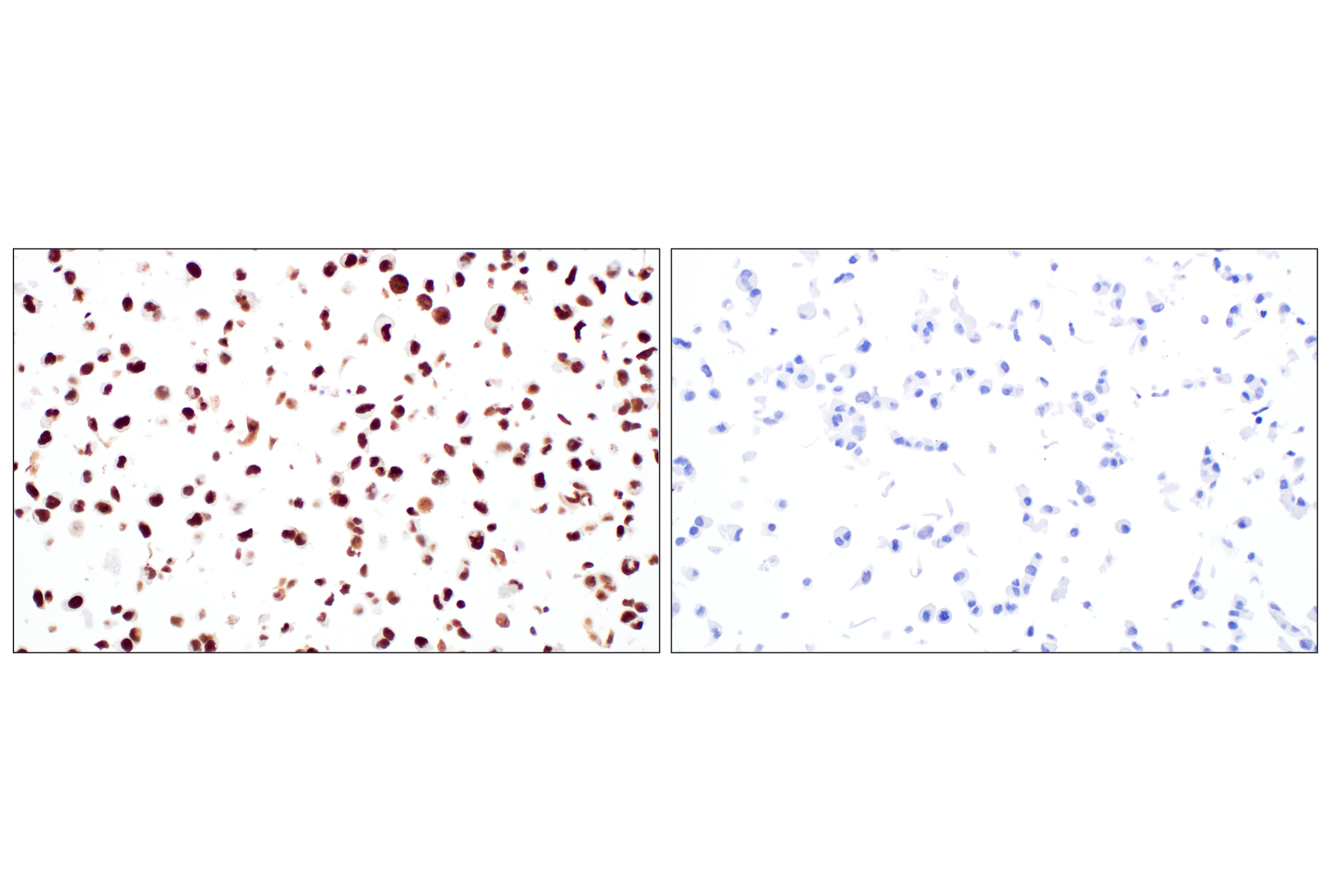 Immunohistochemistry Image 6: CT45 (F7S2I) Rabbit Monoclonal Antibody