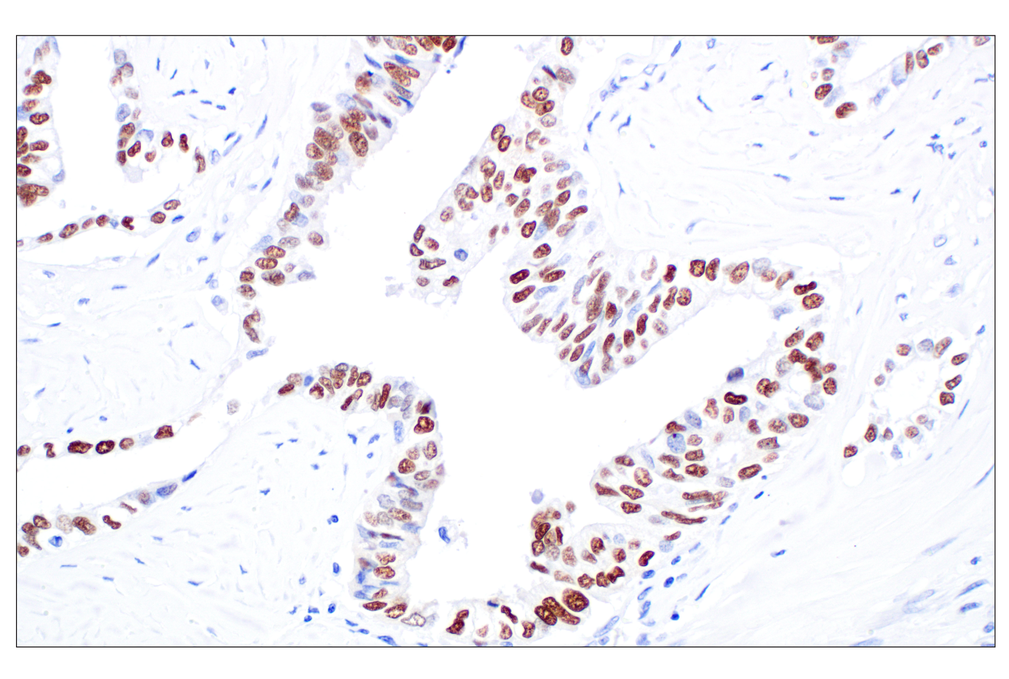 Immunohistochemistry Image 2: CT45 (F7S2I) Rabbit Monoclonal Antibody