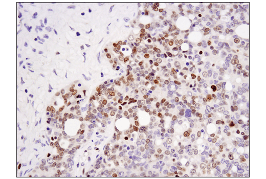 Immunohistochemistry Image 1: DNMT3A (D23G1) Rabbit mAb