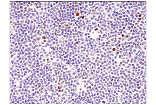 Immunohistochemistry Image 5: DNMT3A (D23G1) Rabbit mAb