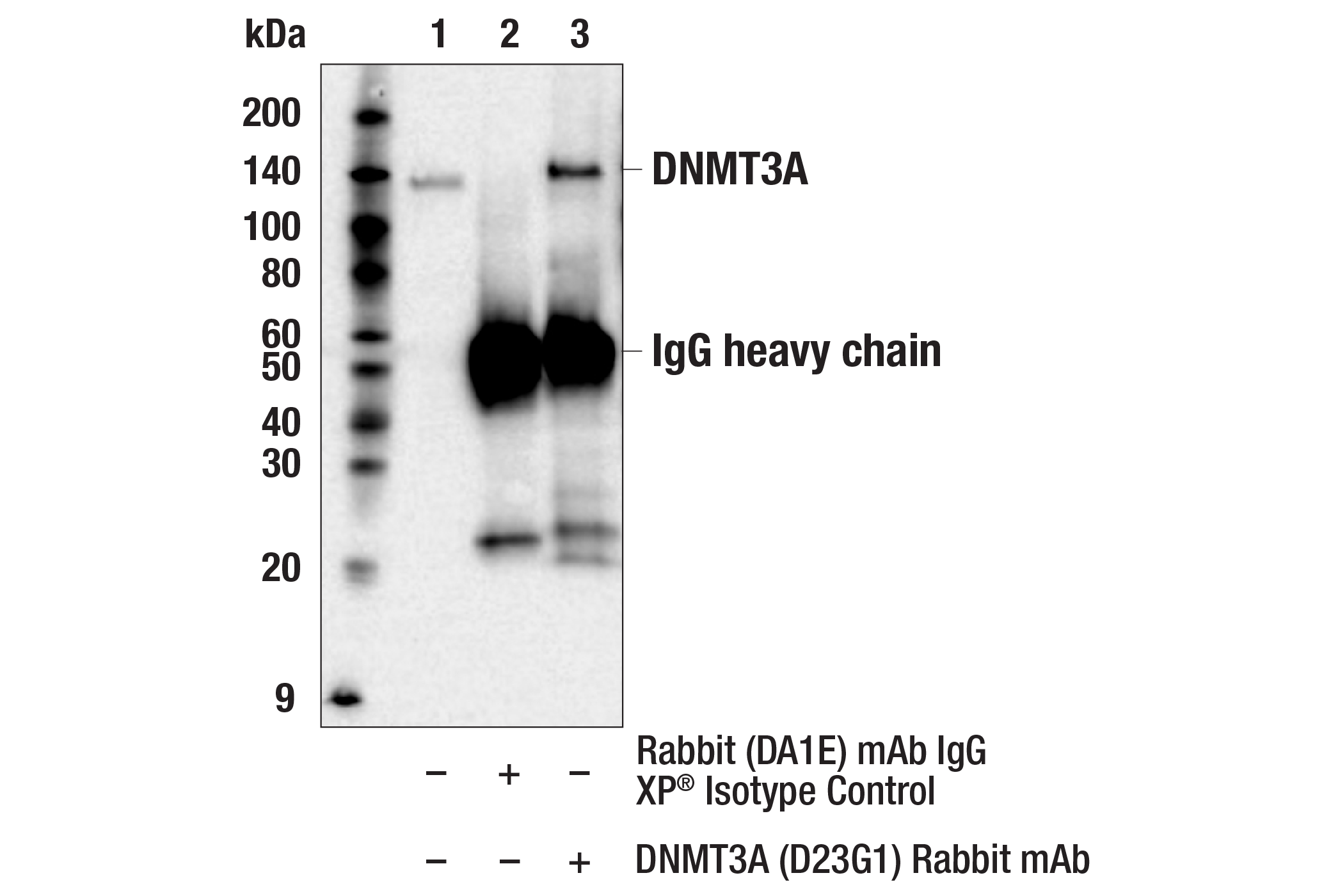 Immunoprecipitation Image 1: DNMT3A (D23G1) Rabbit mAb