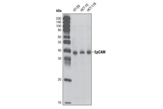 Western Blotting Image 1: EpCAM Antibody