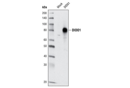 Western Blotting Image 1: DIDO1 Antibody