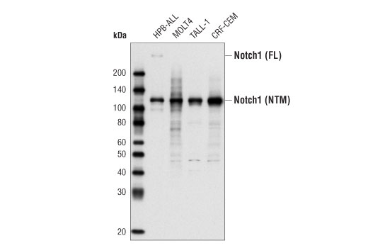  Image 5: Notch Activated Targets Antibody Sampler Kit