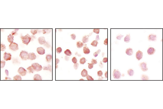Immunohistochemistry Image 3: Notch1 (D1E11) XP® Rabbit mAb