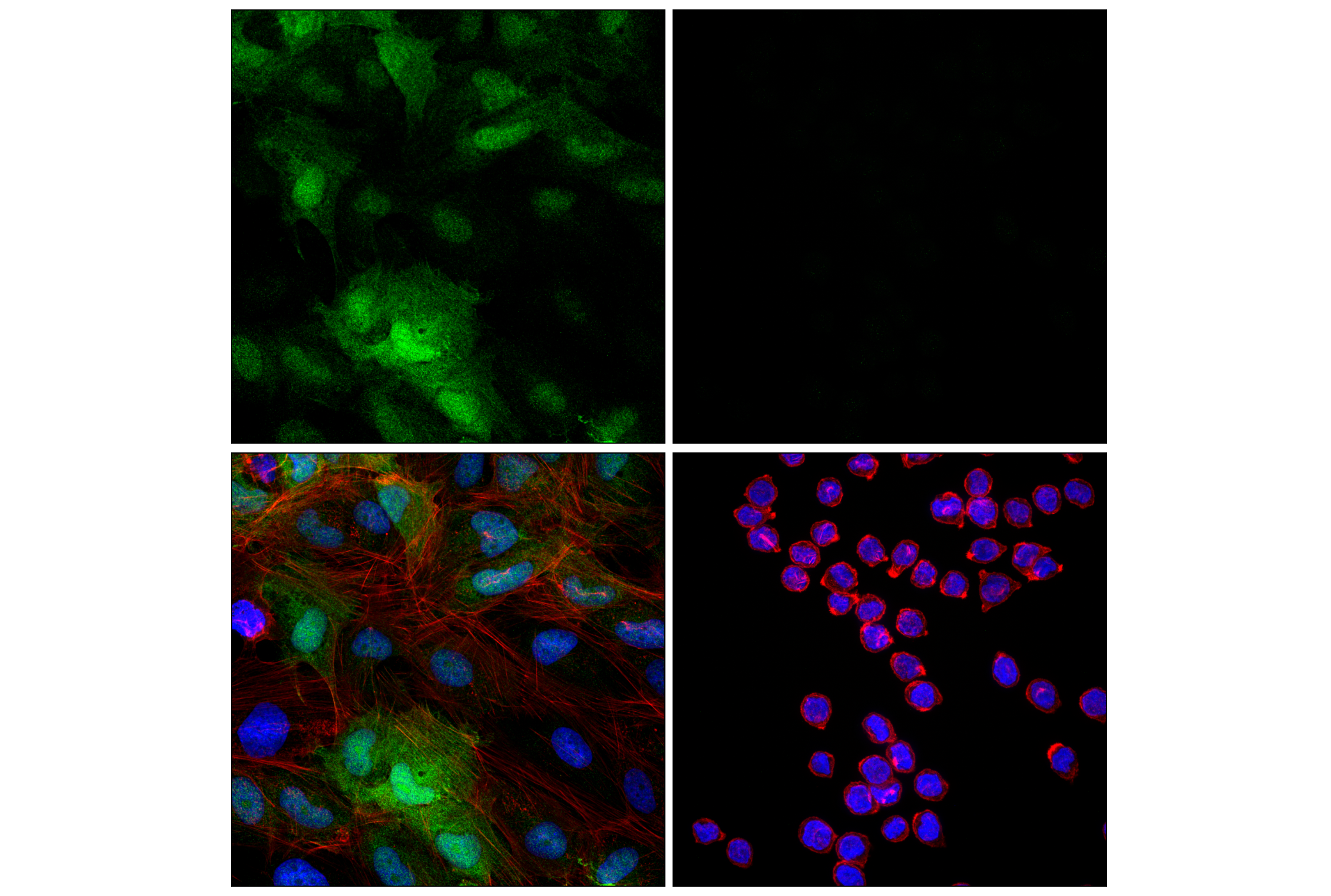 Immunofluorescence Image 4: Transgelin/TAGLN (F3B7H) Rabbit mAb
