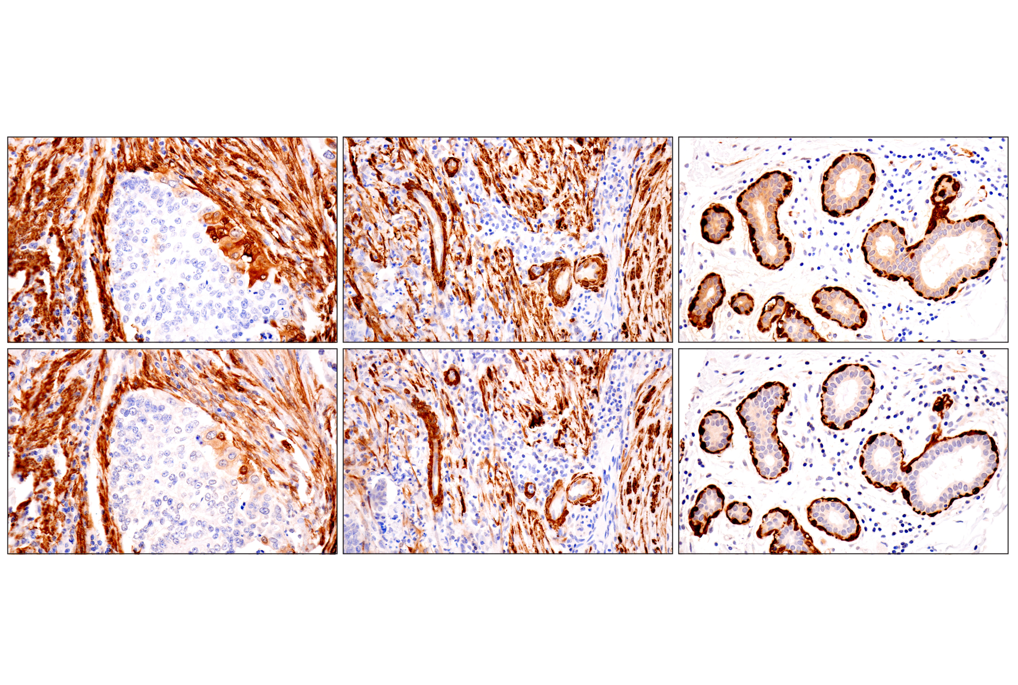 Immunohistochemistry Image 11: Transgelin/TAGLN (F3B7H) Rabbit mAb
