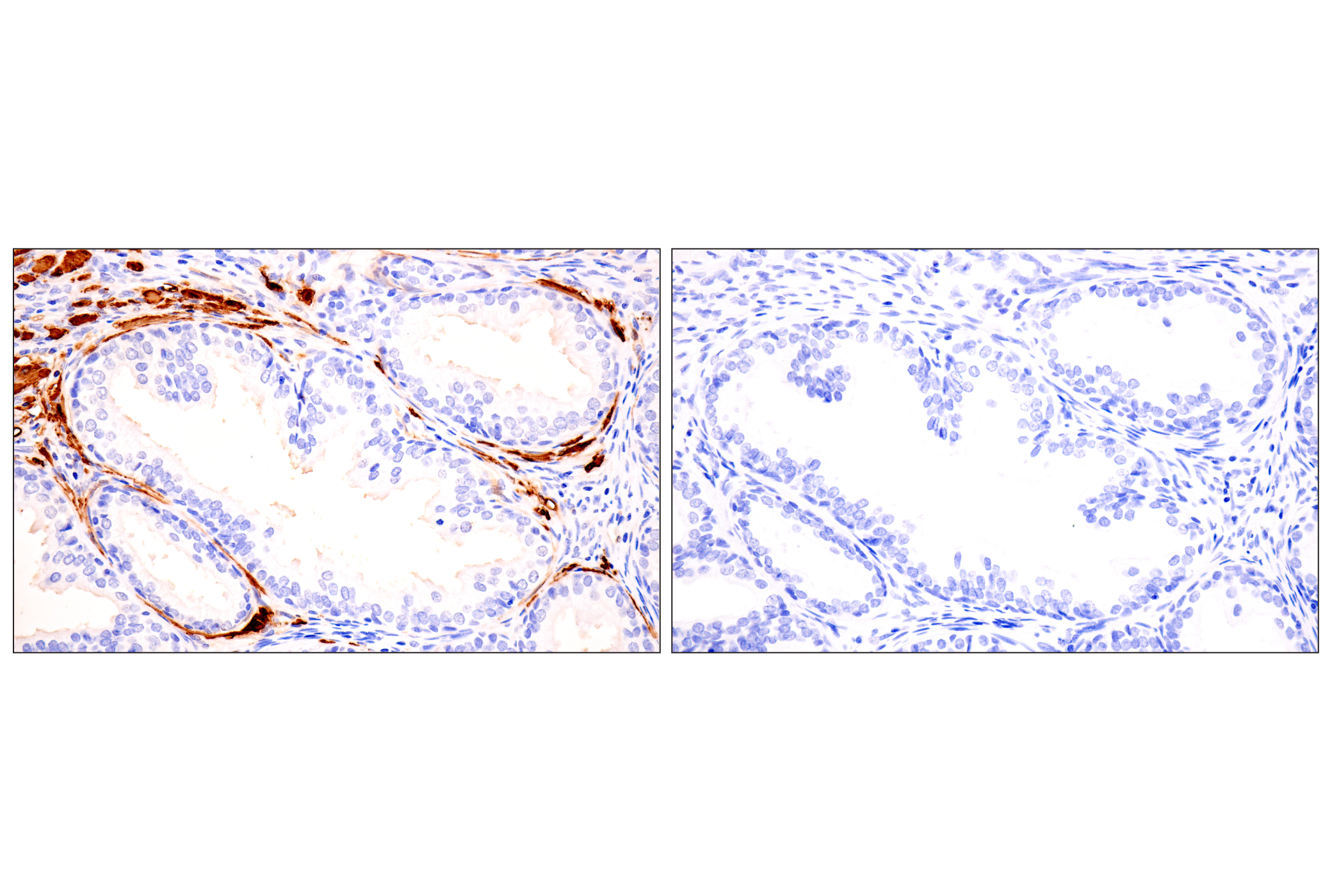 Immunohistochemistry Image 16: Transgelin/TAGLN (F3B7H) Rabbit mAb