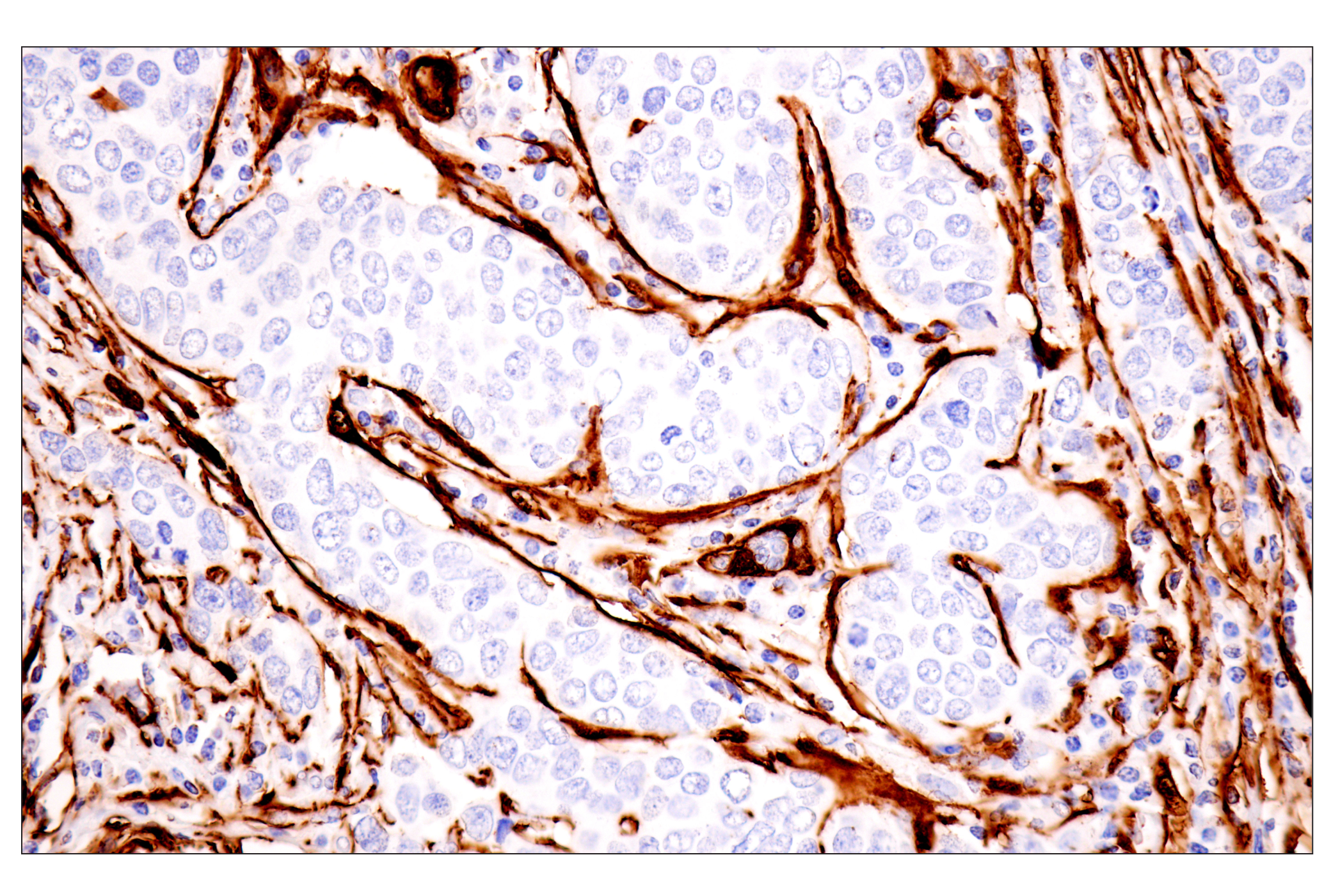 Immunohistochemistry Image 4: Transgelin/TAGLN (F3B7H) Rabbit mAb
