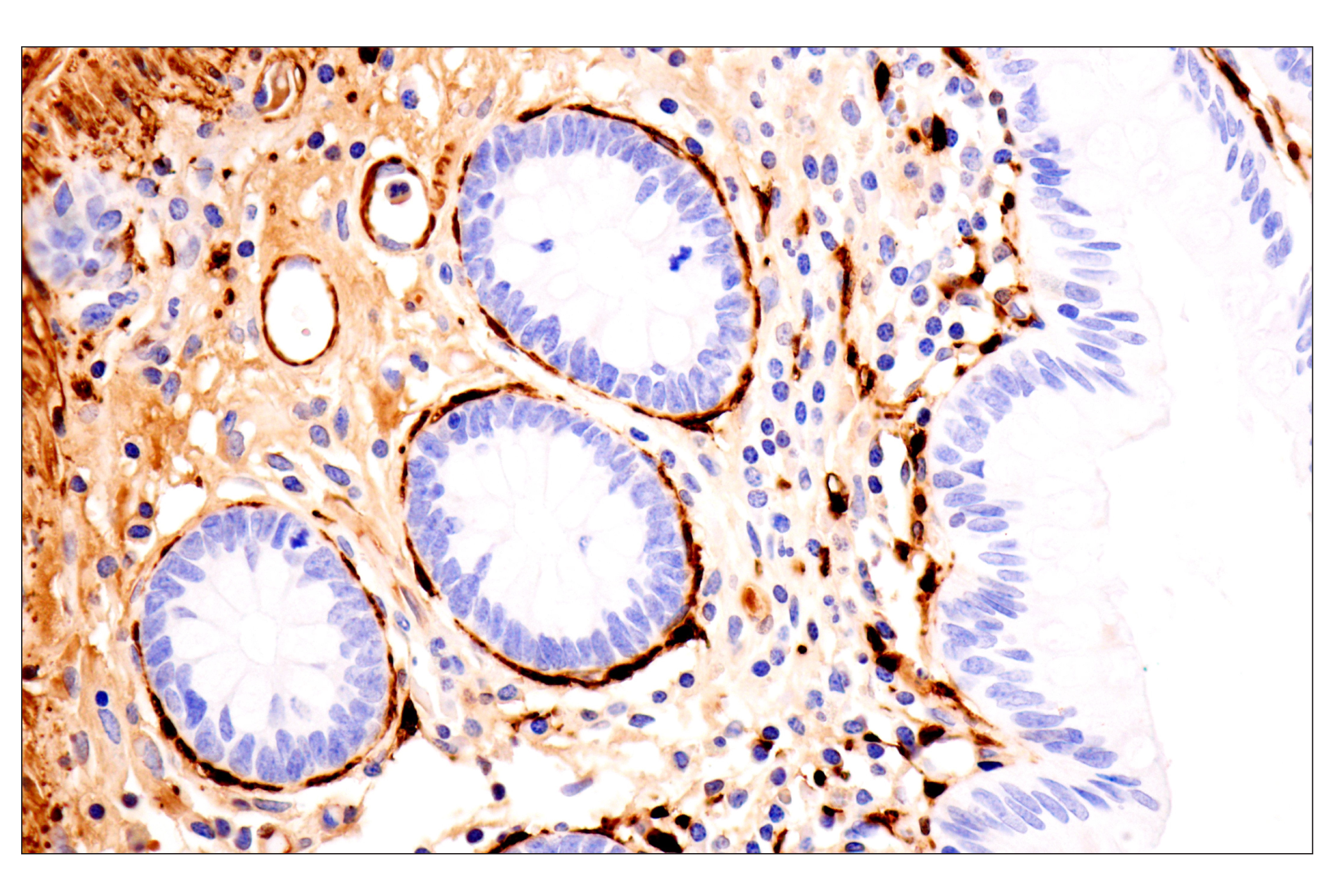 Immunohistochemistry Image 10: Transgelin/TAGLN (F3B7H) Rabbit mAb