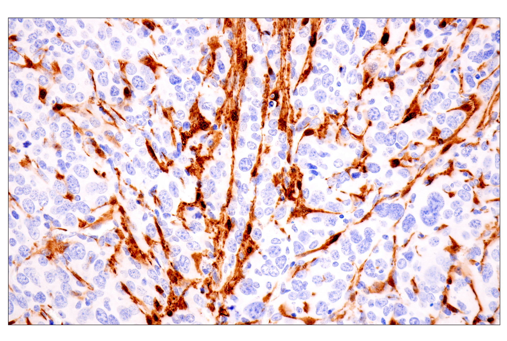 Immunohistochemistry Image 12: Transgelin/TAGLN (F3B7H) Rabbit mAb