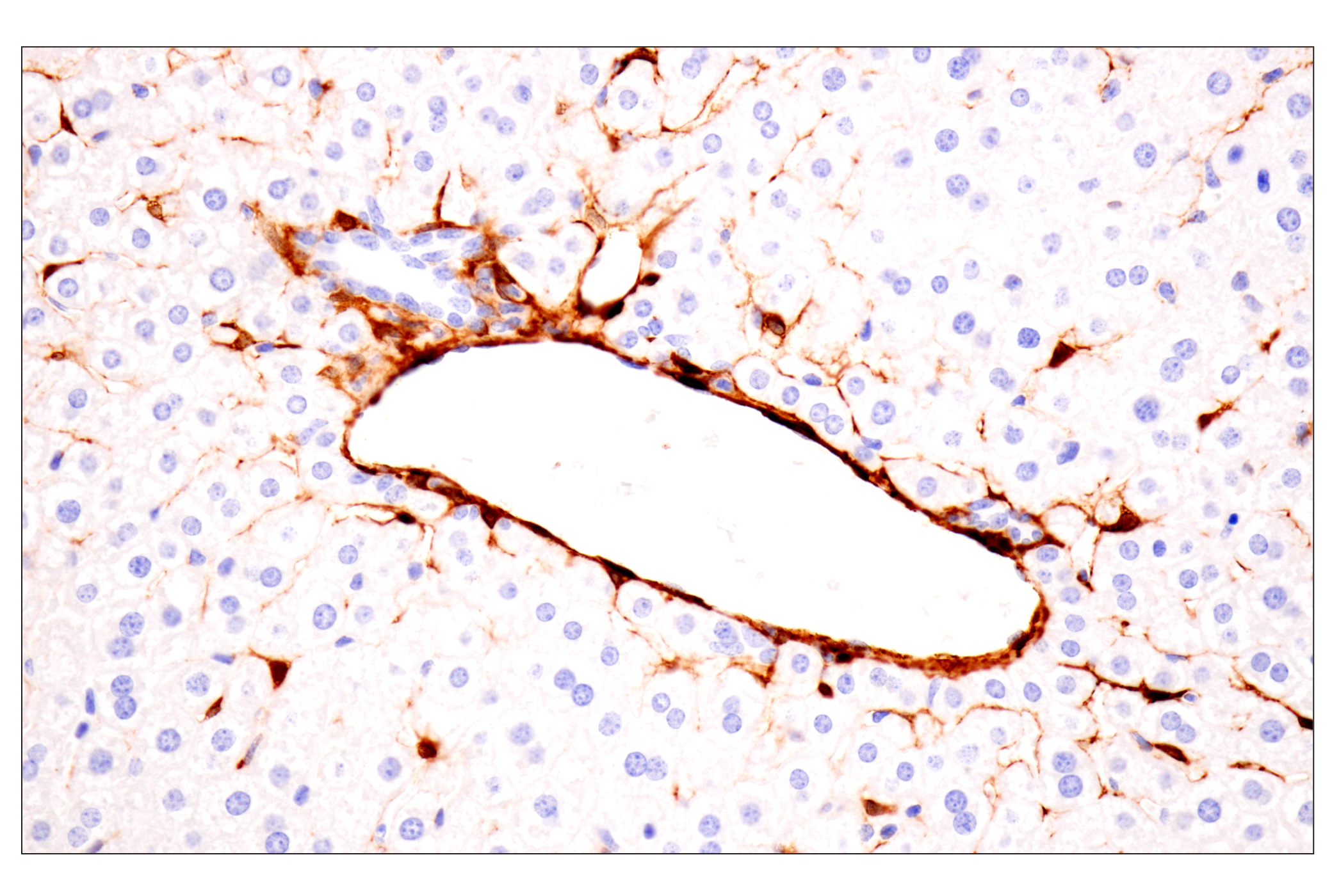 Immunohistochemistry Image 15: Transgelin/TAGLN (F3B7H) Rabbit mAb