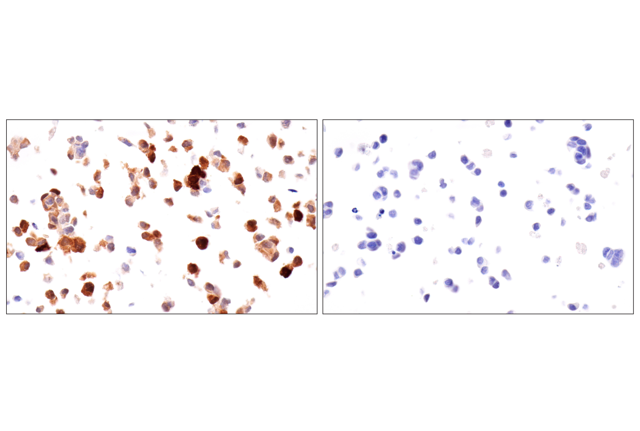 Immunohistochemistry Image 17: Transgelin/TAGLN (F3B7H) Rabbit mAb