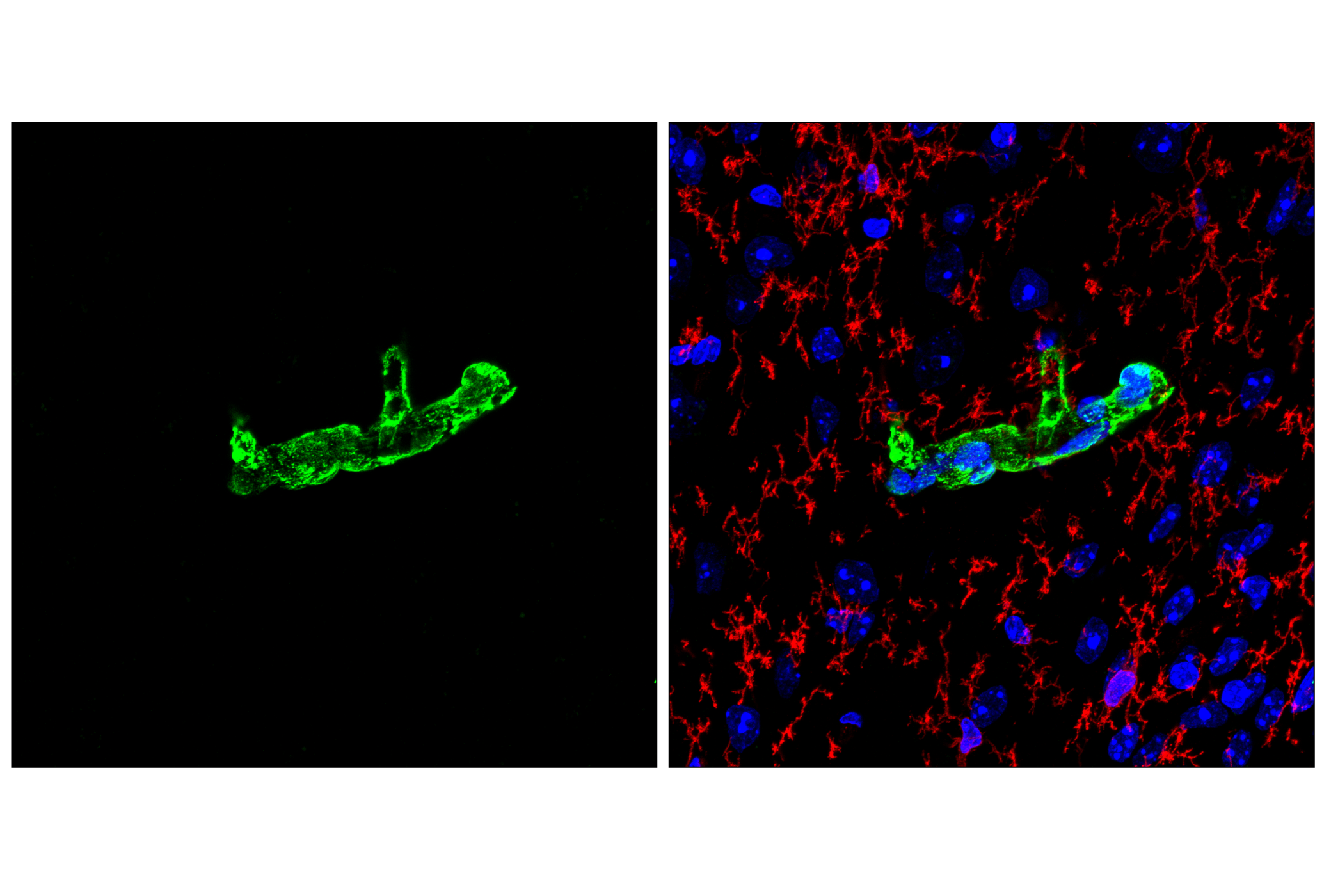 Immunofluorescence Image 1: Transgelin/TAGLN (F3B7H) Rabbit mAb