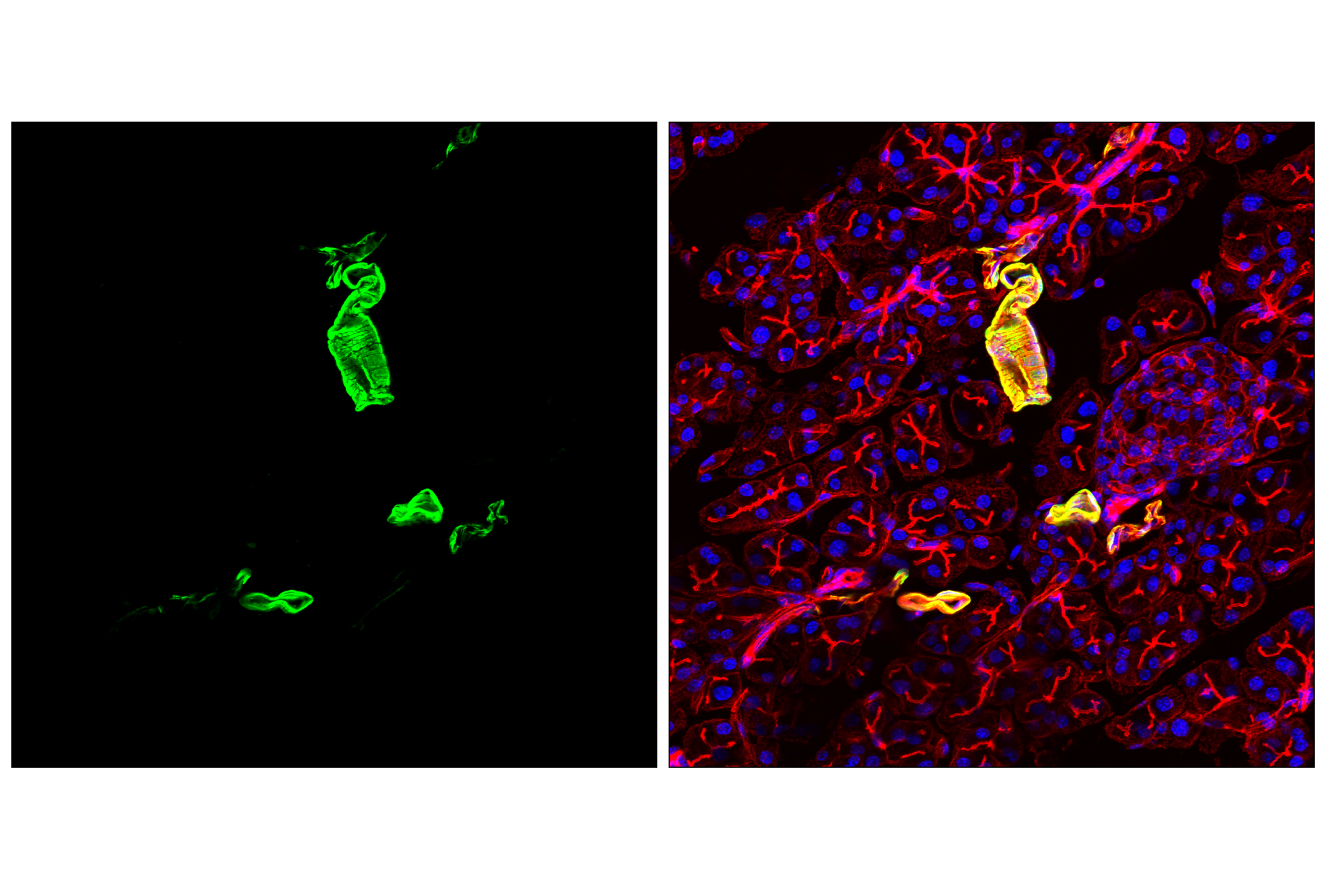 Immunofluorescence Image 2: Transgelin/TAGLN (F3B7H) Rabbit mAb