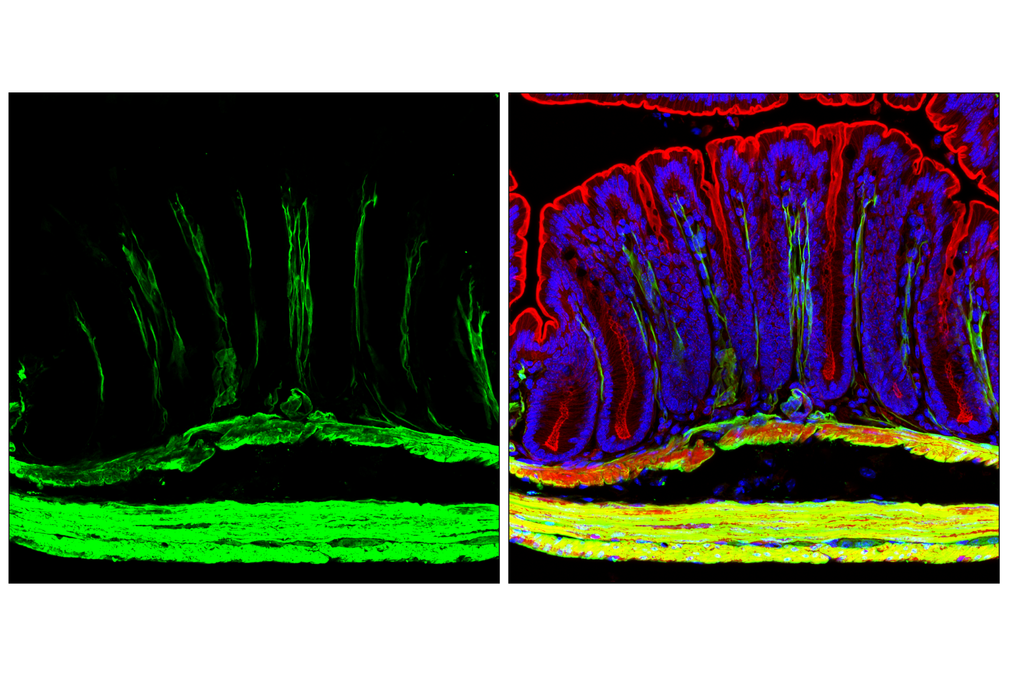 Immunofluorescence Image 3: Transgelin/TAGLN (F3B7H) Rabbit mAb