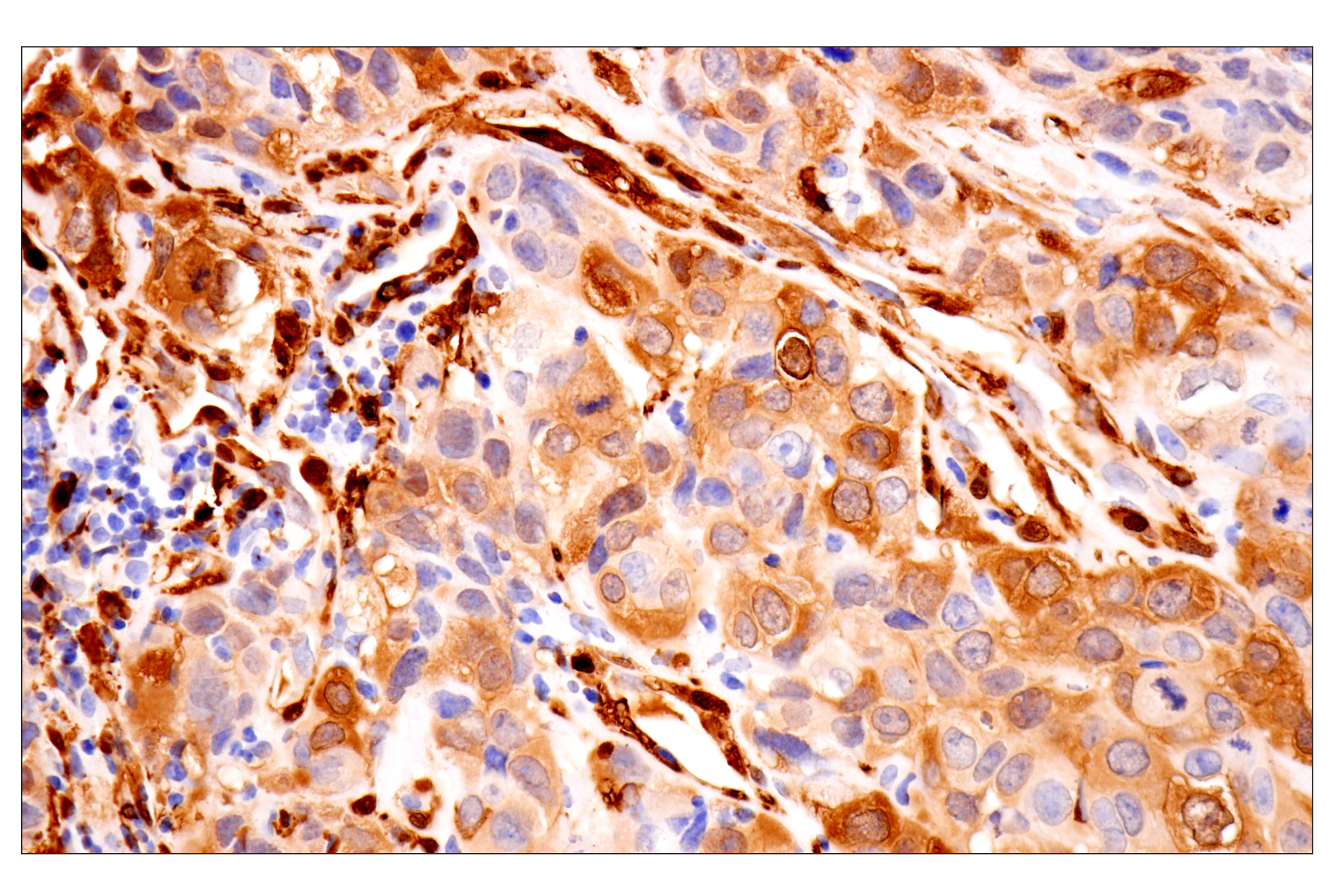 Immunohistochemistry Image 7: Transgelin/TAGLN (F3B7H) Rabbit mAb