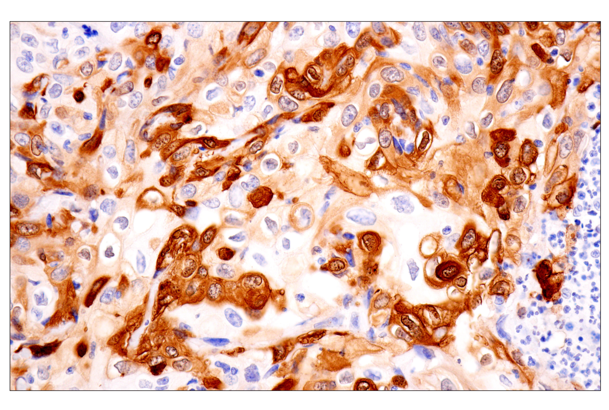 Immunohistochemistry Image 3: Transgelin/TAGLN (F3B7H) Rabbit mAb