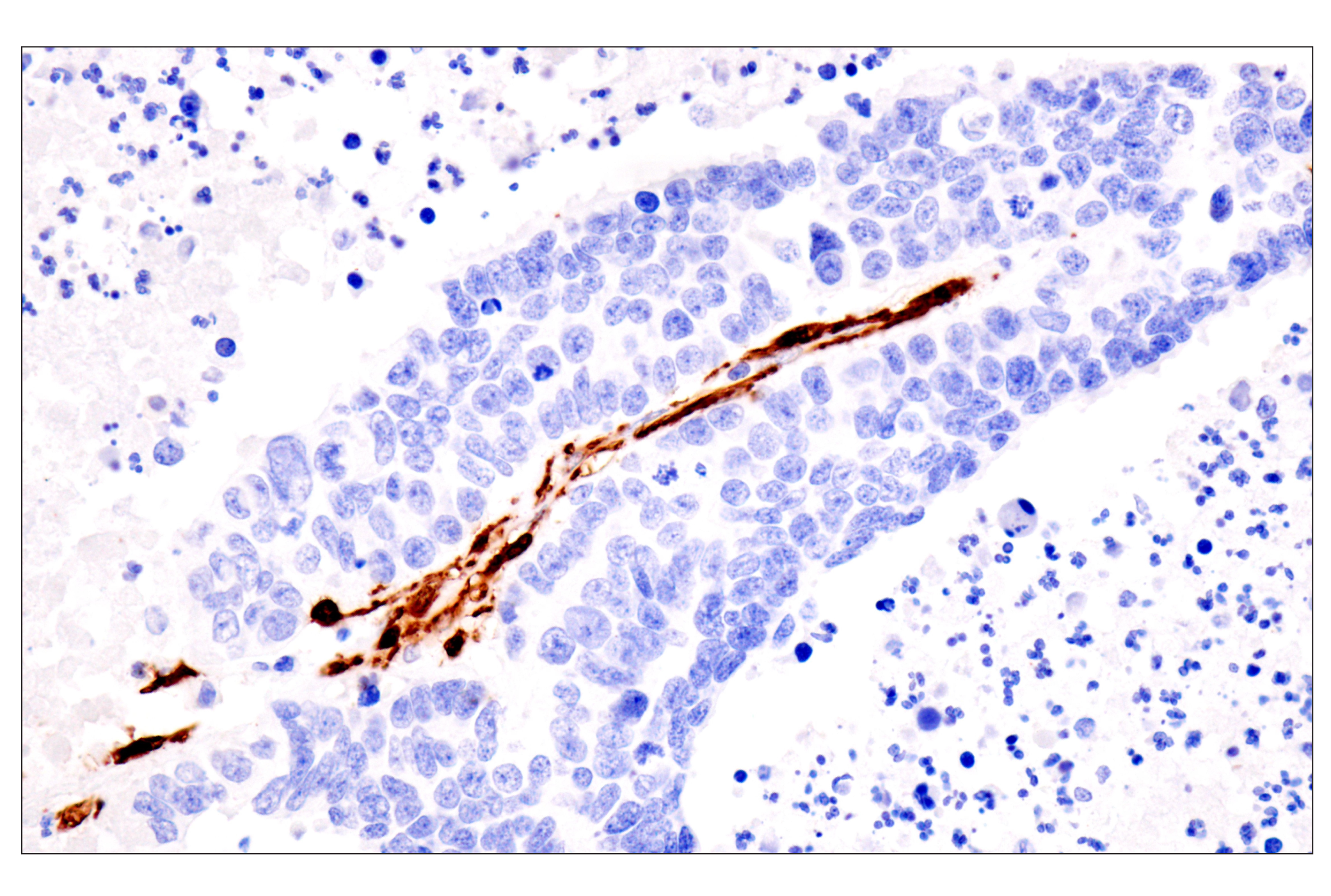 Immunohistochemistry Image 9: Transgelin/TAGLN (F3B7H) Rabbit mAb