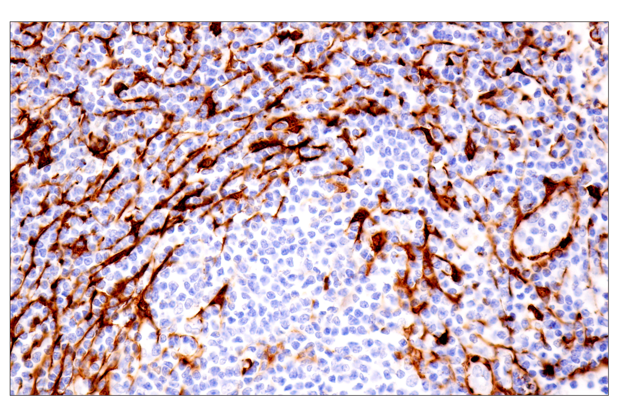 Immunohistochemistry Image 8: Transgelin/TAGLN (F3B7H) Rabbit mAb