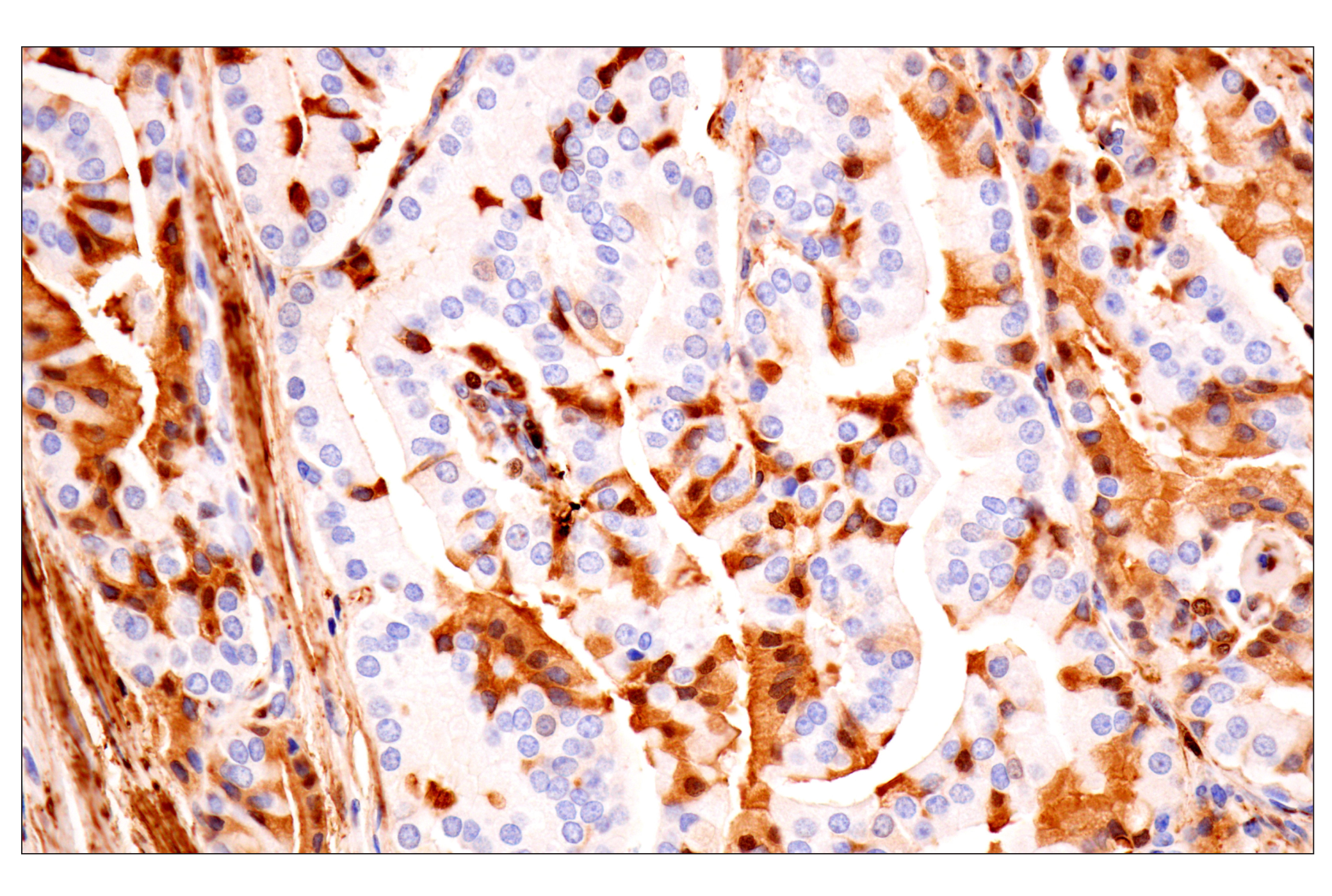 Immunohistochemistry Image 5: Transgelin/TAGLN (F3B7H) Rabbit mAb
