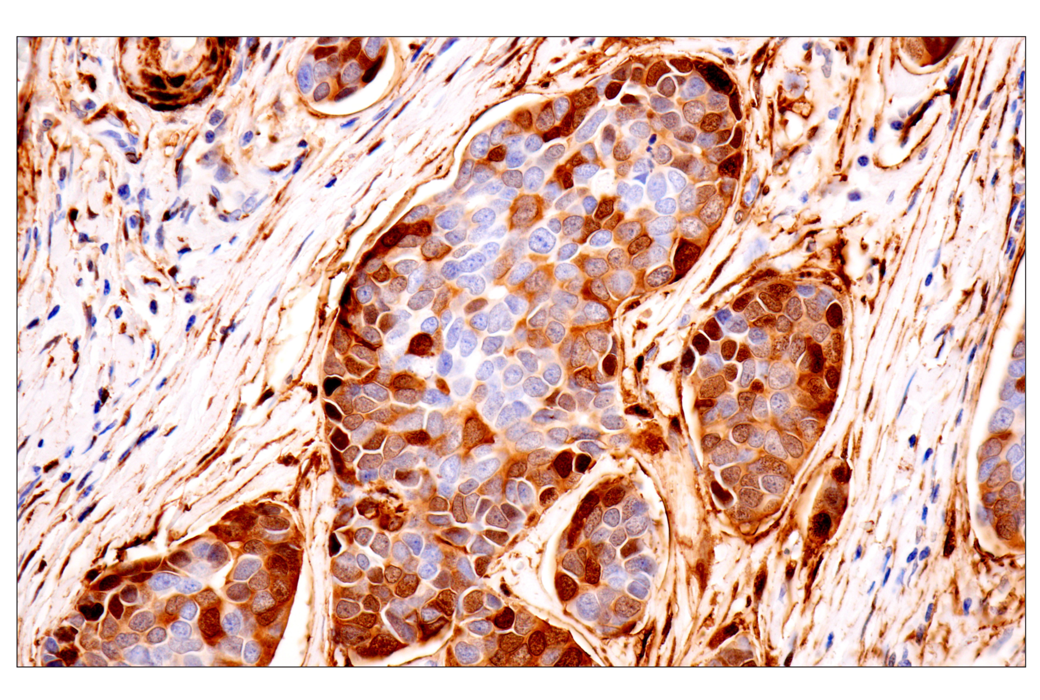Immunohistochemistry Image 1: Transgelin/TAGLN (F3B7H) Rabbit mAb