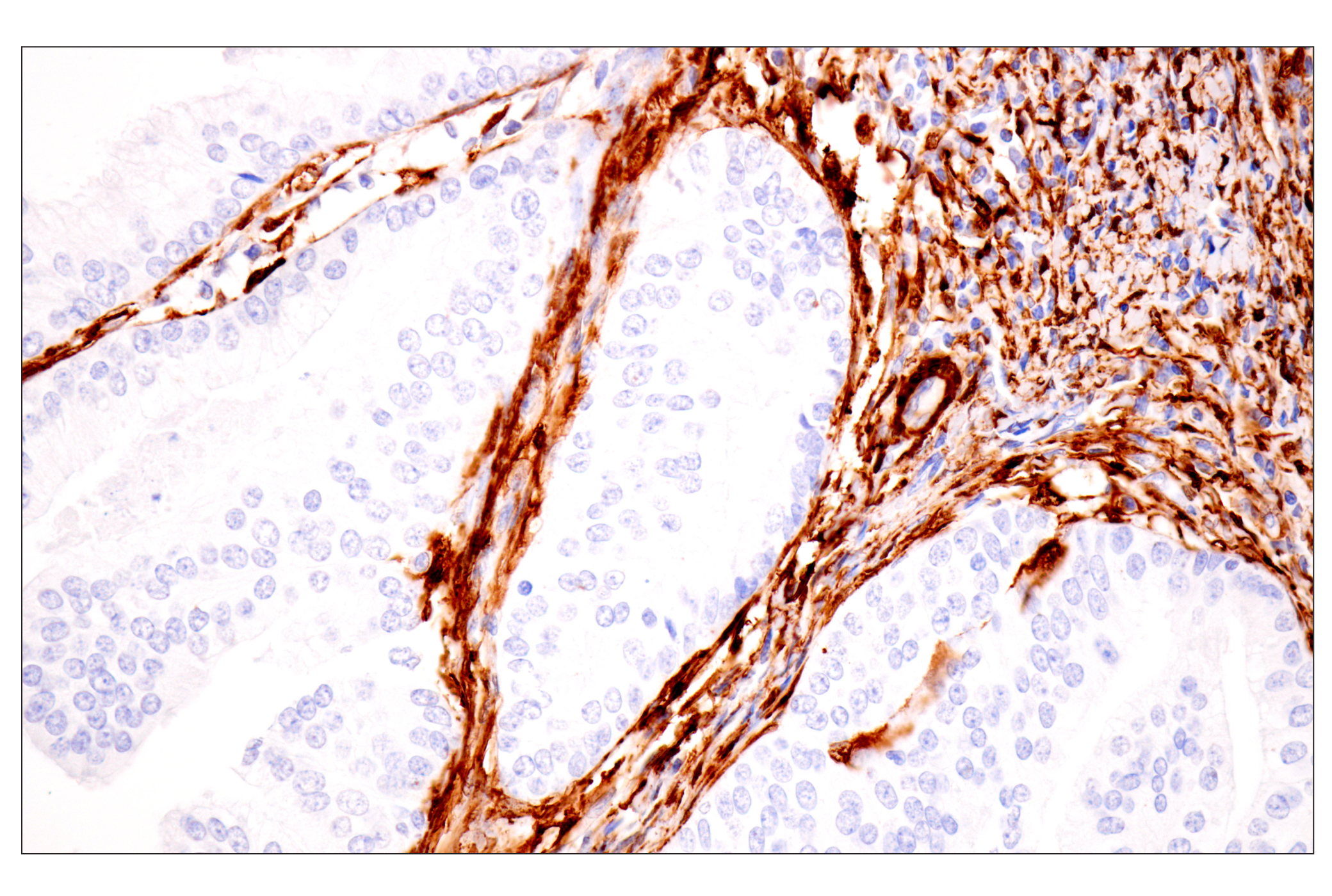 Immunohistochemistry Image 2: Transgelin/TAGLN (F3B7H) Rabbit mAb