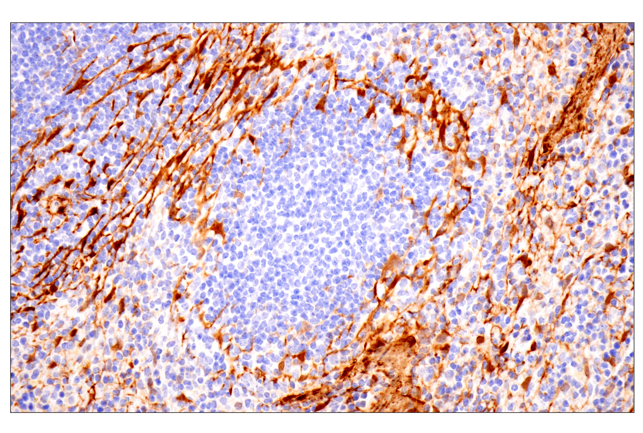 Immunohistochemistry Image 14: Transgelin/TAGLN (F3B7H) Rabbit mAb