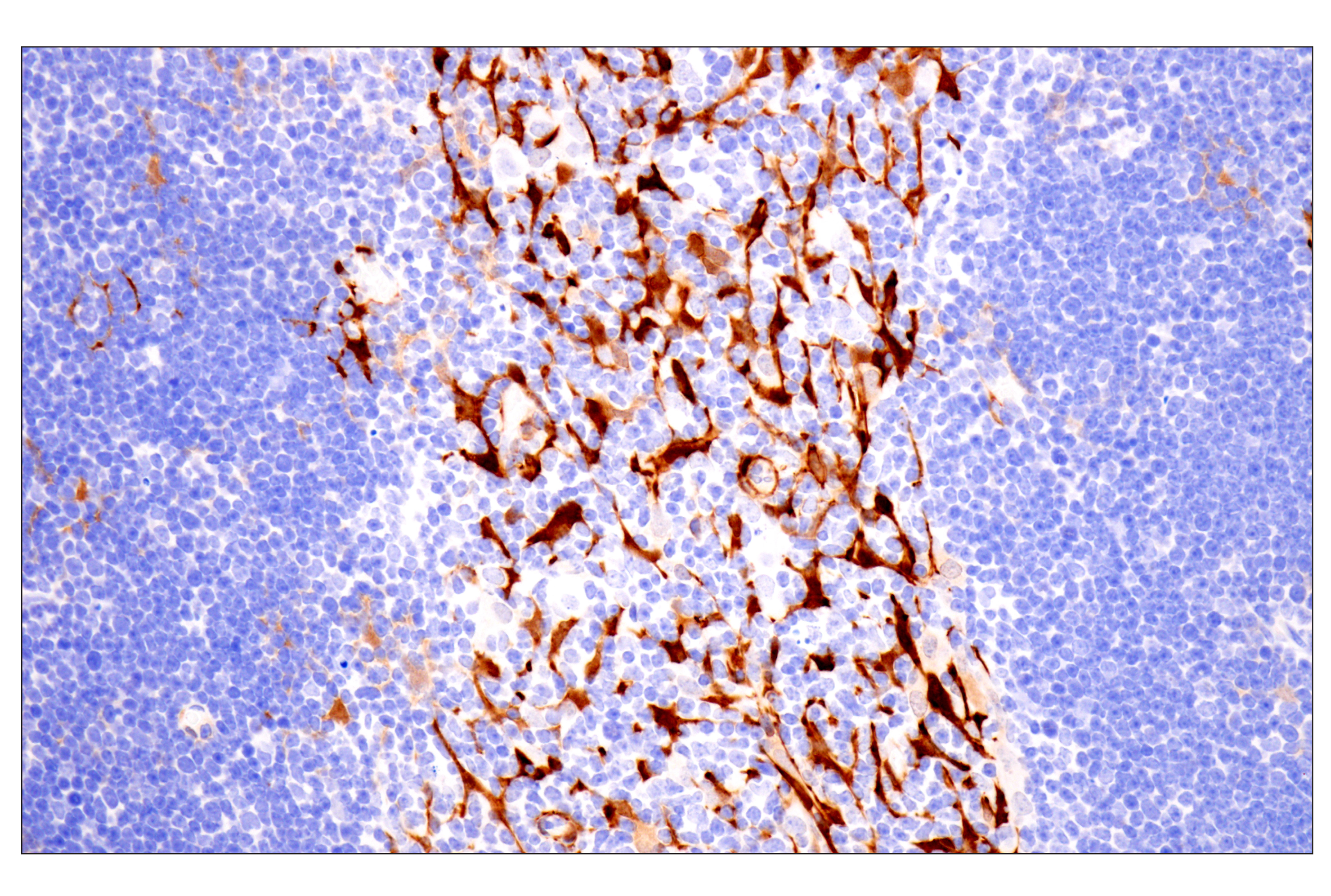 Immunohistochemistry Image 13: Transgelin/TAGLN (F3B7H) Rabbit mAb