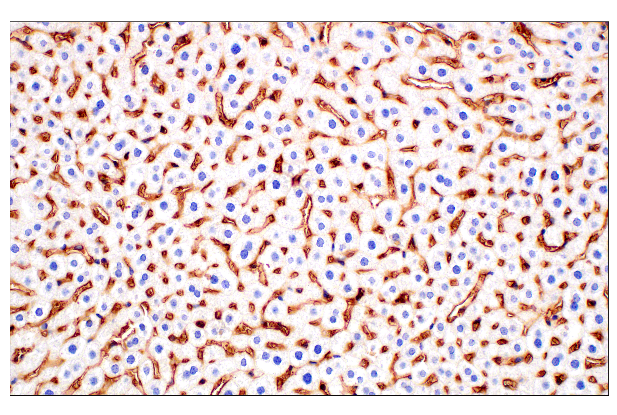 Immunohistochemistry Image 1: CD47 (E2V9V) Rabbit mAb