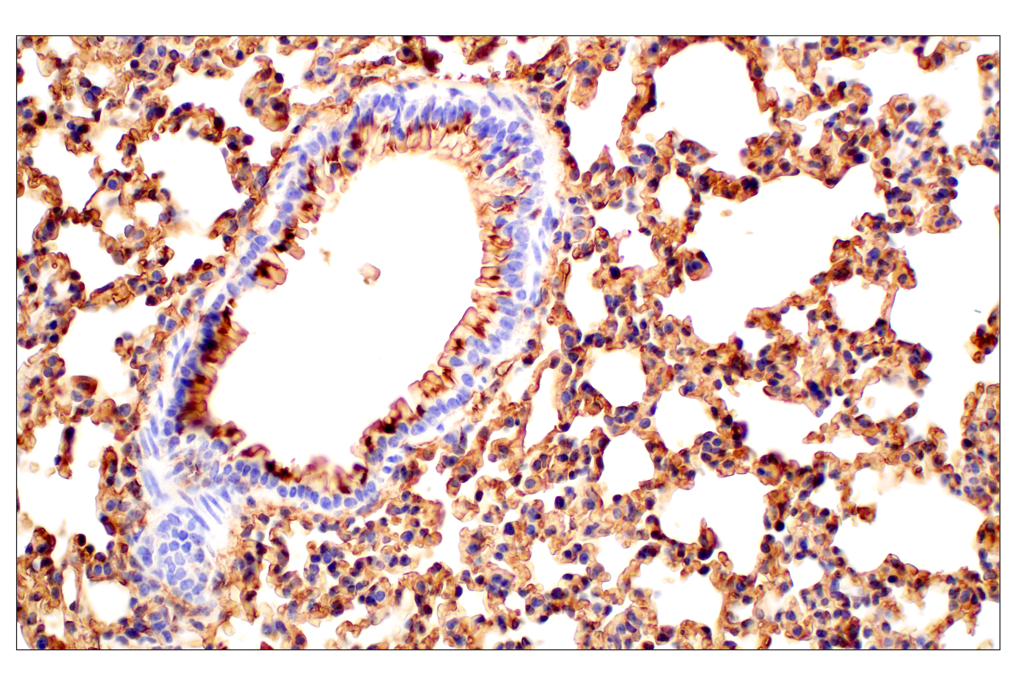 Immunohistochemistry Image 5: CD47 (E2V9V) Rabbit mAb
