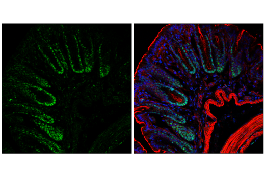 Immunofluorescence Image 1: NSUN2 (E6N6I) Rabbit mAb