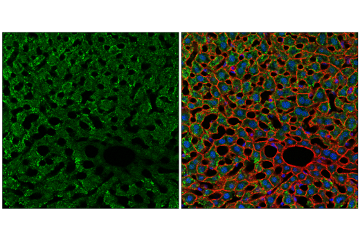 Immunofluorescence Image 2: NSUN2 (E6N6I) Rabbit mAb