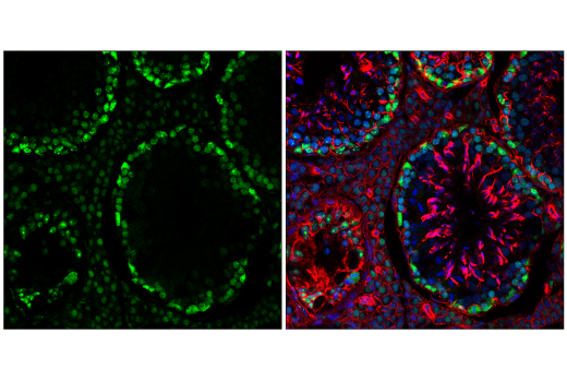 Immunofluorescence Image 3: NSUN2 (E6N6I) Rabbit mAb