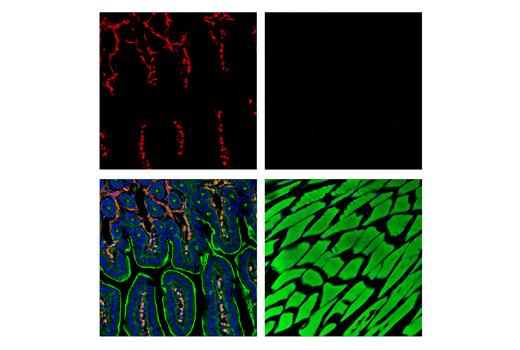 Immunofluorescence Image 1: α-Smooth Muscle Actin (D4K9N) XP® Rabbit mAb (Alexa Fluor® 594 Conjugate)